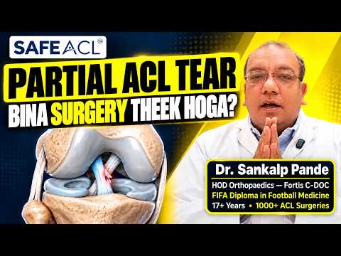 Partial ACL tear: does it need surgery?