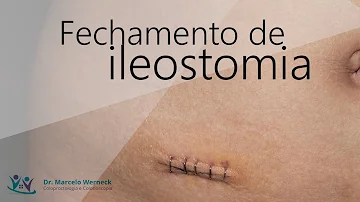 O que acontece depois da reversão de colostomia?
