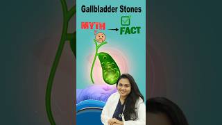 Are Gallbladder Stones Dangerous? Myths & Facts #ytshorts #gallbladderstones #gallstones #yt