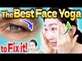 The Best Face Yoga Routine that Works Better than Botox to Remove Droopy Eyelids and Eye Wrinkles