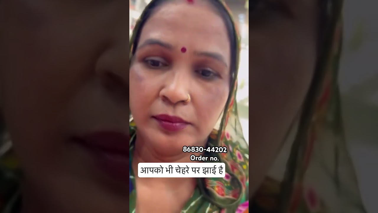 Magical Cream for your pigmentation 