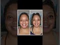5-month weight loss progress