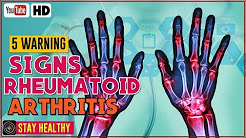 5 WARNING SIGNS AND SYMPTOMS OF RHEUMATOID ARTHRITIS