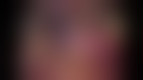 ROBOTIC CENTRAL HEPATECTOMY FOR HEPATOCARCINOMA BY GLISSONEAN APPROACH