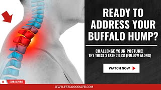 3 Best Exercises for Buffalo Hump Follow Along Routine