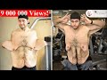 Weight Loss ~Their Transformation after Loose Skin Removal! ~ Body Bizarre! Part1