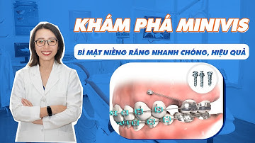 Khám Phá Minivis - Bí Mật Niềng Răng Nhanh Chóng, Hiệu Quả | Nam Bùi Vinalign