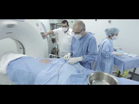 CRYOABLATION من بيروت الى العالم علاج السرطان بالتبريد