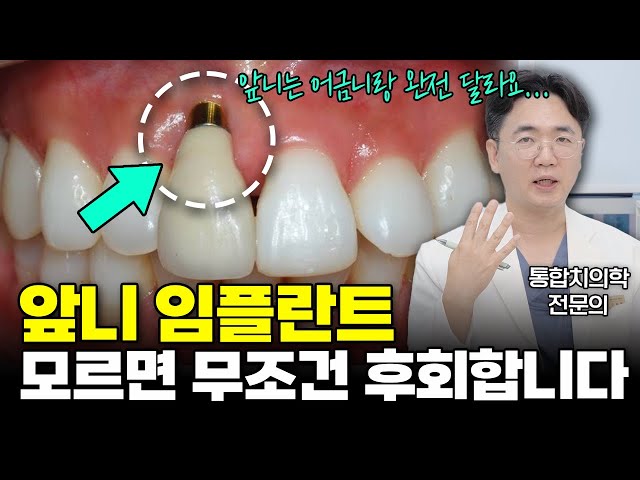 앞니 임플란트는 이렇게 수술해야합니다! 모르면 후회 할 앞니 임플란트 부작용