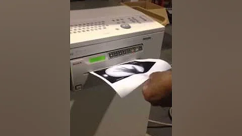 Presentation Philips Pulsera C-Arm