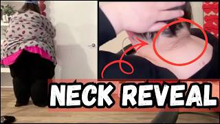 Amberlynns mouldy neck reveal on LOLCOW Bus