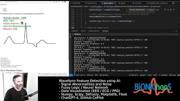 Building an ECG Analysis Bot: Coding, Fuzzy Logic, and Algorithmic Challenges