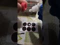 Blood grouping Test waits for the result 🏥🧪🥼