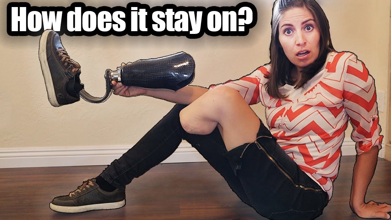 How Do Prosthetics Stay On?