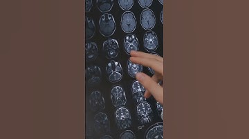 :"The 10% Brain Myth: What You’re Not Being Told"