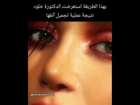 الدكتورة خلوج تغير أنفها.. وهكذا اصبح شكلها وجهها