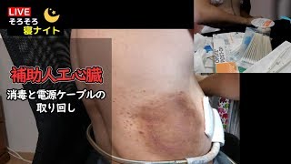 消毒と電源ケーブルの取り回し◇そろそろ寝ナイト