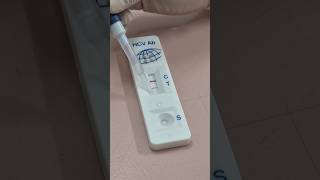 Testing Process | Blood Sample Testing in Laboratory | Medical Lab Work #diagnosticlabs