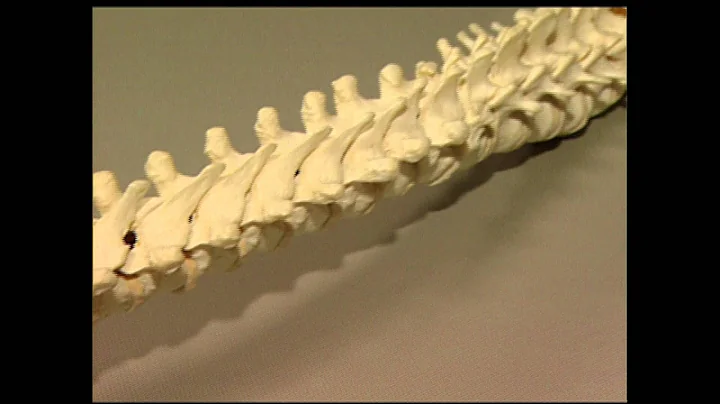 UCLA Spine Patient Story - Langston Holly, MD | UC...
