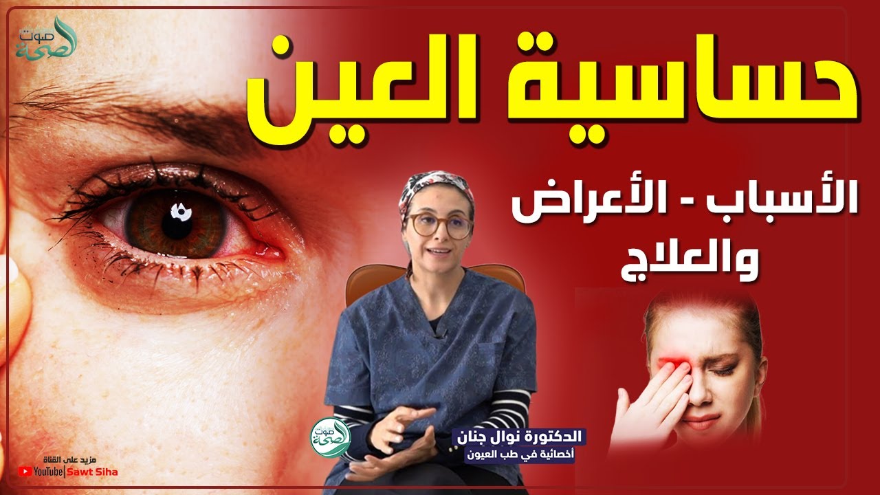 أسباب حساسية العين وطرق العلاج | الدكتورة نوال جنان أخصائية في طب العيون