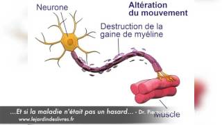 Sclérose en plaques avec le Dr Pierre-Jean Thomas-Lamotte