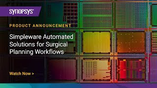 Celebrity Simpleware Automated Solutions for Surgical Planning Workflows | Synopsys Wealth
