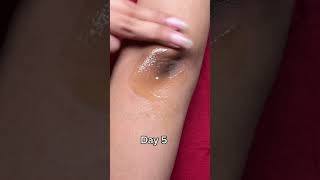 Dark Elbow to Brighter Elbows in 7 Days? 😱✨ | Skincare Transformation #Shorts