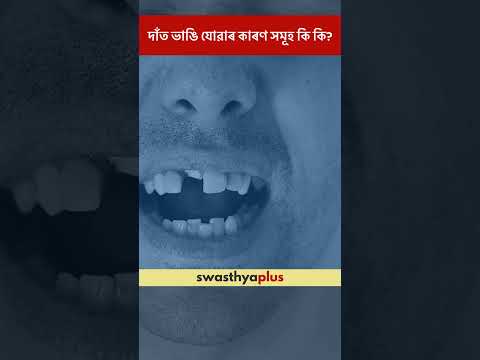 দাঁ‌ত ভাঙি যোৱাৰ কাৰণ সমূহ কি কি? | Causes of Cracks in Teeth | Dr Manjil Mousam Sabanya | #Shorts
