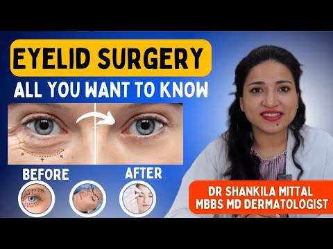 blepharoplasty for loose eye lid skin and eyebags - MBBS MD (MAMC) (SKIN)- HINDI 2023