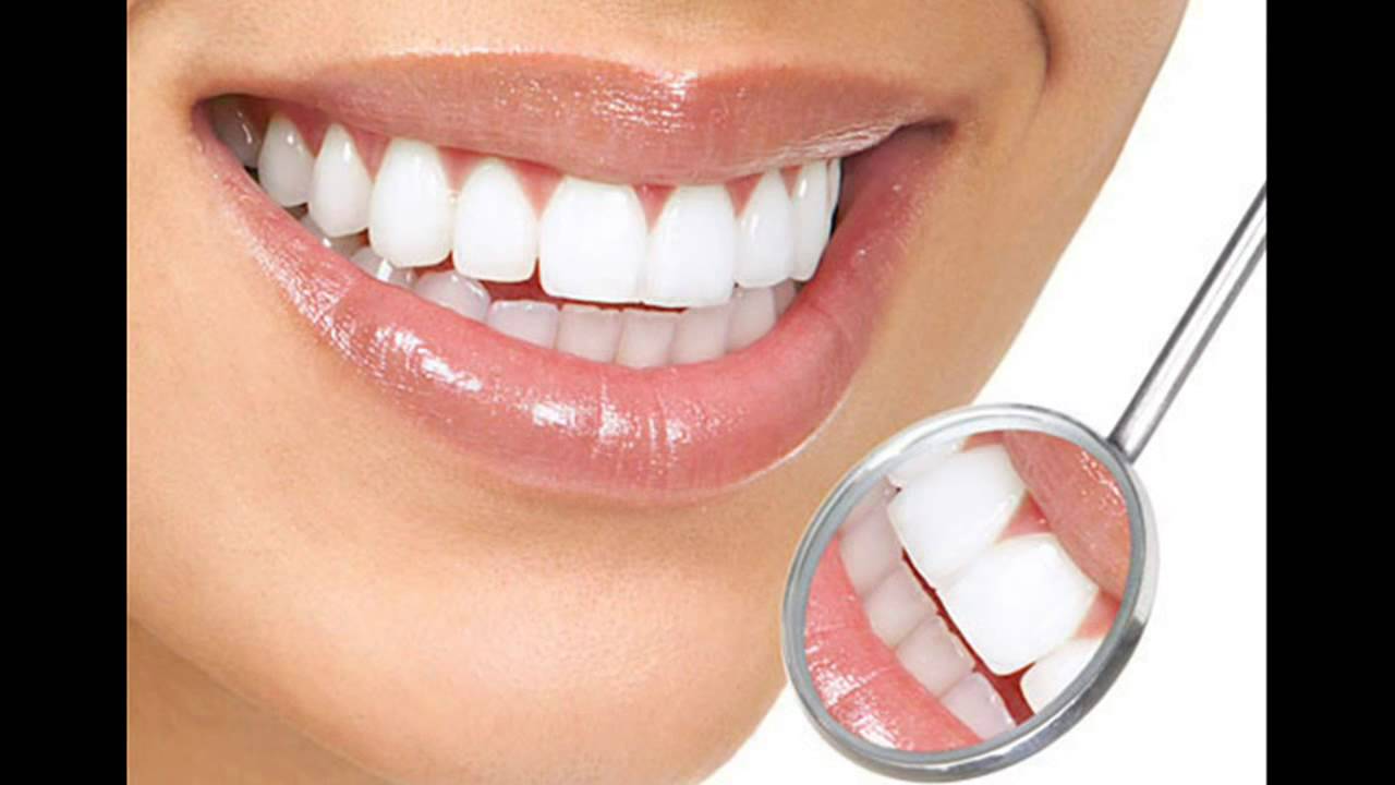 Teeth Whitening 4 You Review