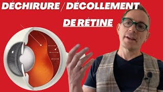 Décollement et déchirure de rétine, mouches ou éclaires dans les yeux (Maladie des yeux)