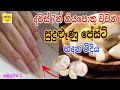 සුදුළූණු වලින් සතියෙන් නියපොතු වවන ක්‍රමය | How to grow long nails fast with garlic paste