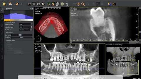 2  How to draw panoramic curve