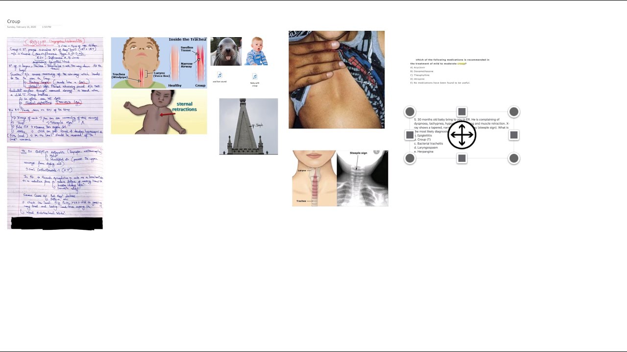 Croup YouTube