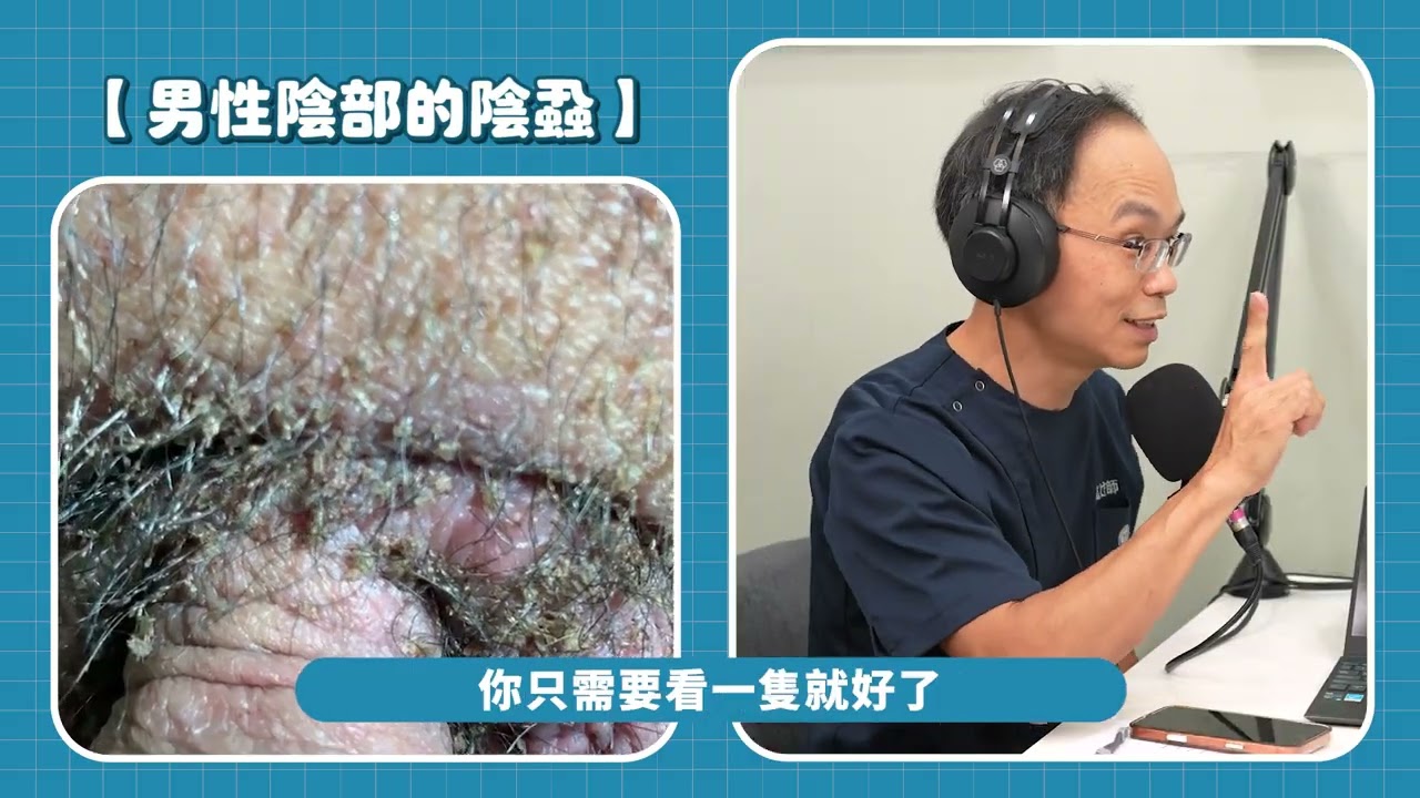 Podcast衛教影音 性傳染病與性健康 陰蝨錄 縮圖