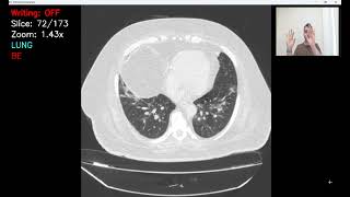 Python Gesture Annotation Tool for DICOM