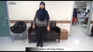 Tutu MAMMADOVA Parkinson Beyin Pili Ameliyatı Öncesi ve 10 Gün sonrası
