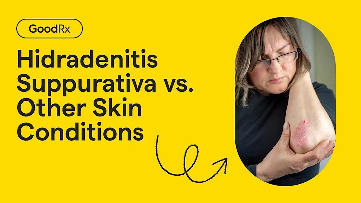 Hidradenitis Suppurativa vs. Other Skin Conditions: How to Tell the Difference | GoodRx