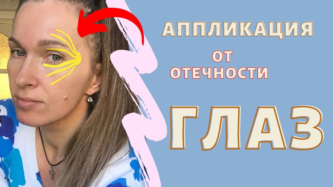 Аппликация от отечности ГЛАЗ.👀 / Тейпирование Глаз/Как убрать ...