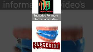 Famous Sports Mouthguard for braces #short #viral #dental Net Worth