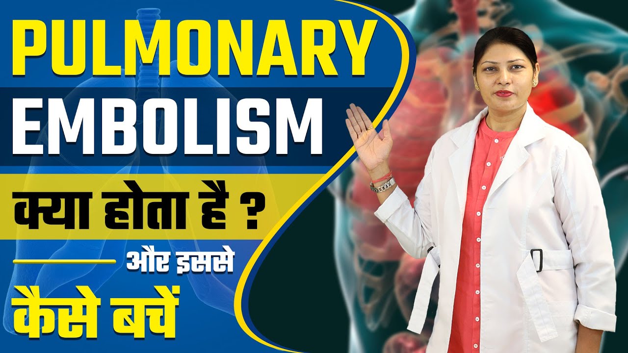 pulmonary-embolism-pulmonary-embolism-in