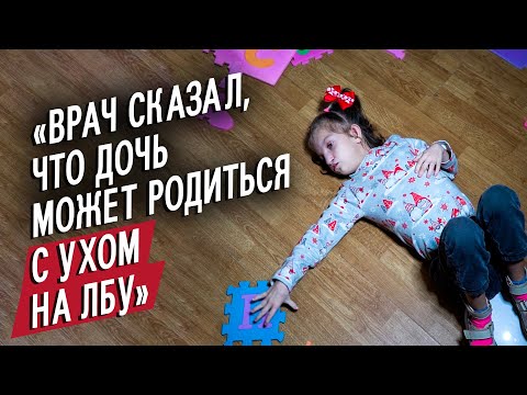 Video: Вольф Хиршхорн синдромуна эмне себеп болот?