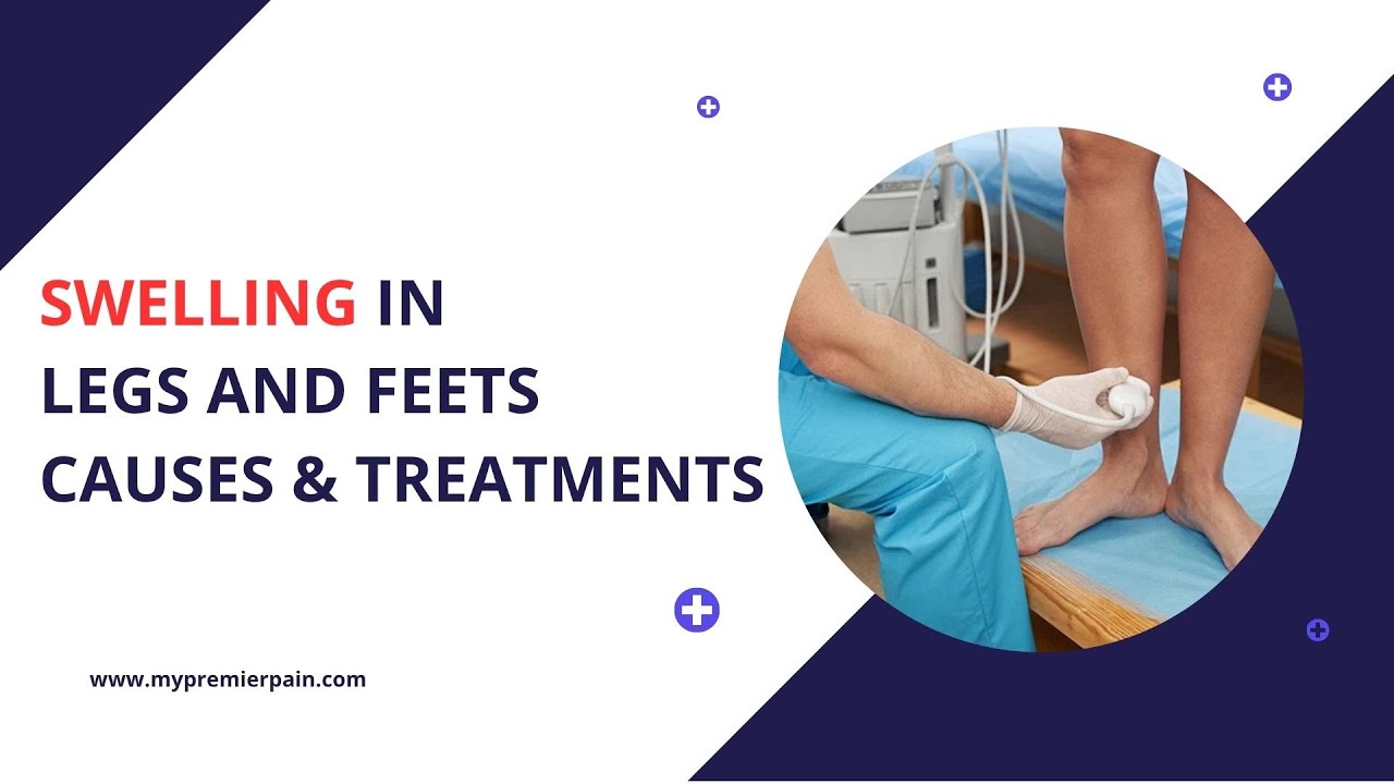 Swelling in Legs & Feet – Causes, Symptoms & Effective Treatments | Premier Pain Centers