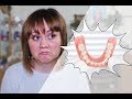 22. Dentures/Съемные зубные протезы: 3 года спустя