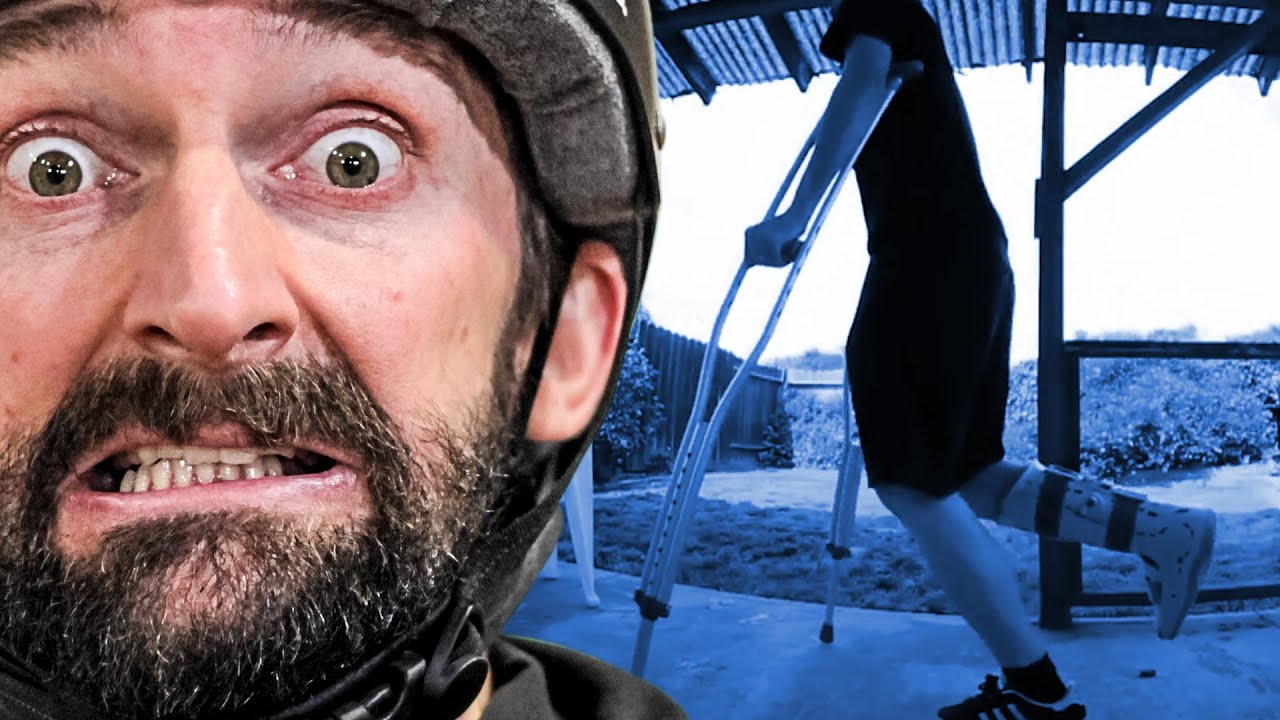 HOW TO HEAL FROM A SKATEBOARD INJURY