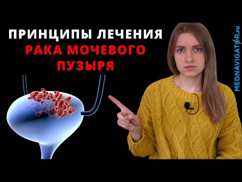 Все о лечении РАКА МОЧЕВОГО ПУЗЫРЯ - операция, лучевая, химио- и иммунотерапия | Mednavigator.ru