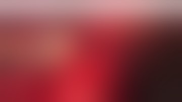 Laparoscopic esophago-jejuno anastomosis by linear stapler