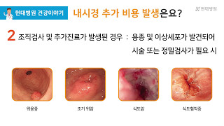 현대병원(Hyundea General Hospital) 건강이야기_위내시경