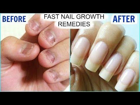 Simple, natural tips to strengthen & grow your nails