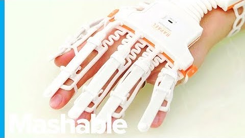 This Smart Glove Could Help Stroke Patients Recover Their Hand Movements